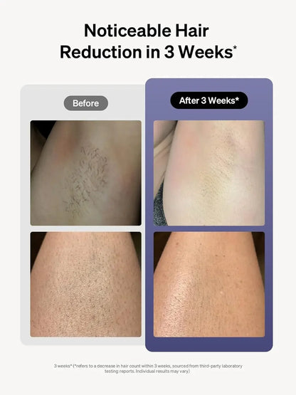 Laser Hair Removal for Women and Men, Air 3 Ice-Cooling IPL Device Hair Removal for Nearly Painless & Long-Lasting Results, 3 Mo